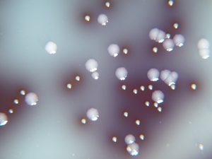 enterococcus on bile aesculin agar
